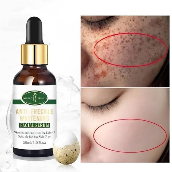 Aichun Anti Freckle Whitening Facial Serum