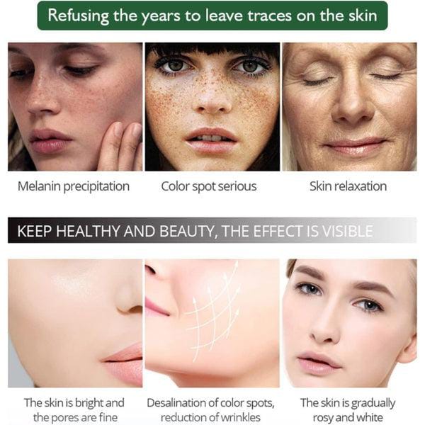 Aichun Anti Freckle Whitening Facial Serum