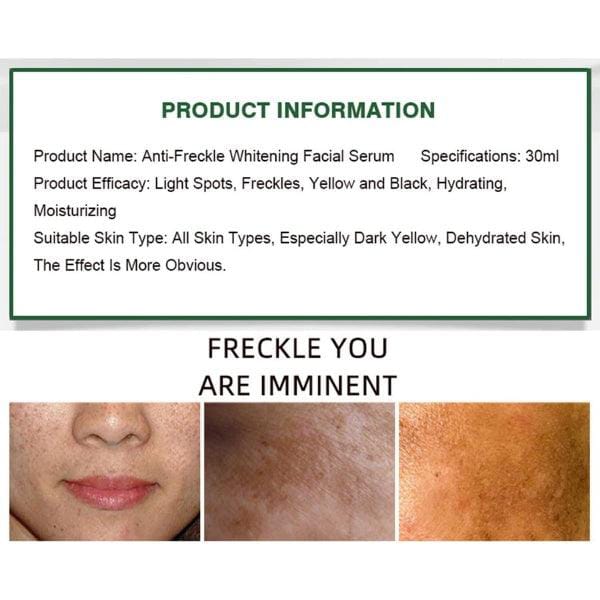 Aichun Anti Freckle Whitening Facial Serum