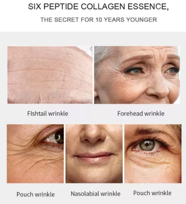 Aichun Beauty Medical Formula Anti-acne Whitening Facial Serum