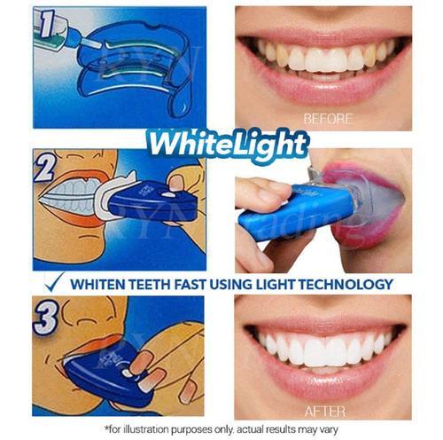 White Light Teeth Whitening Brightener | No Box Card Packing And Cell Operated.